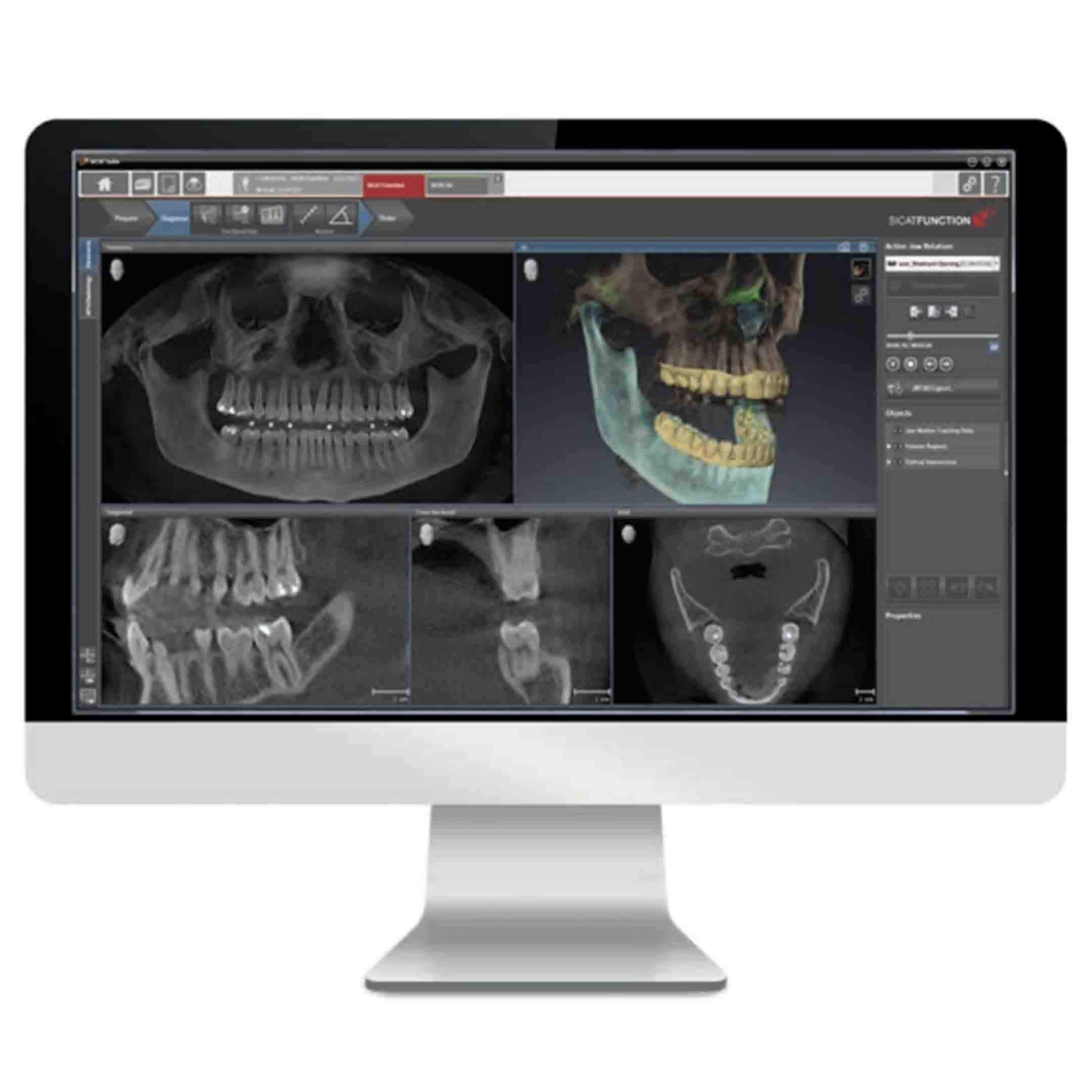 Benefits of Digital X-rays