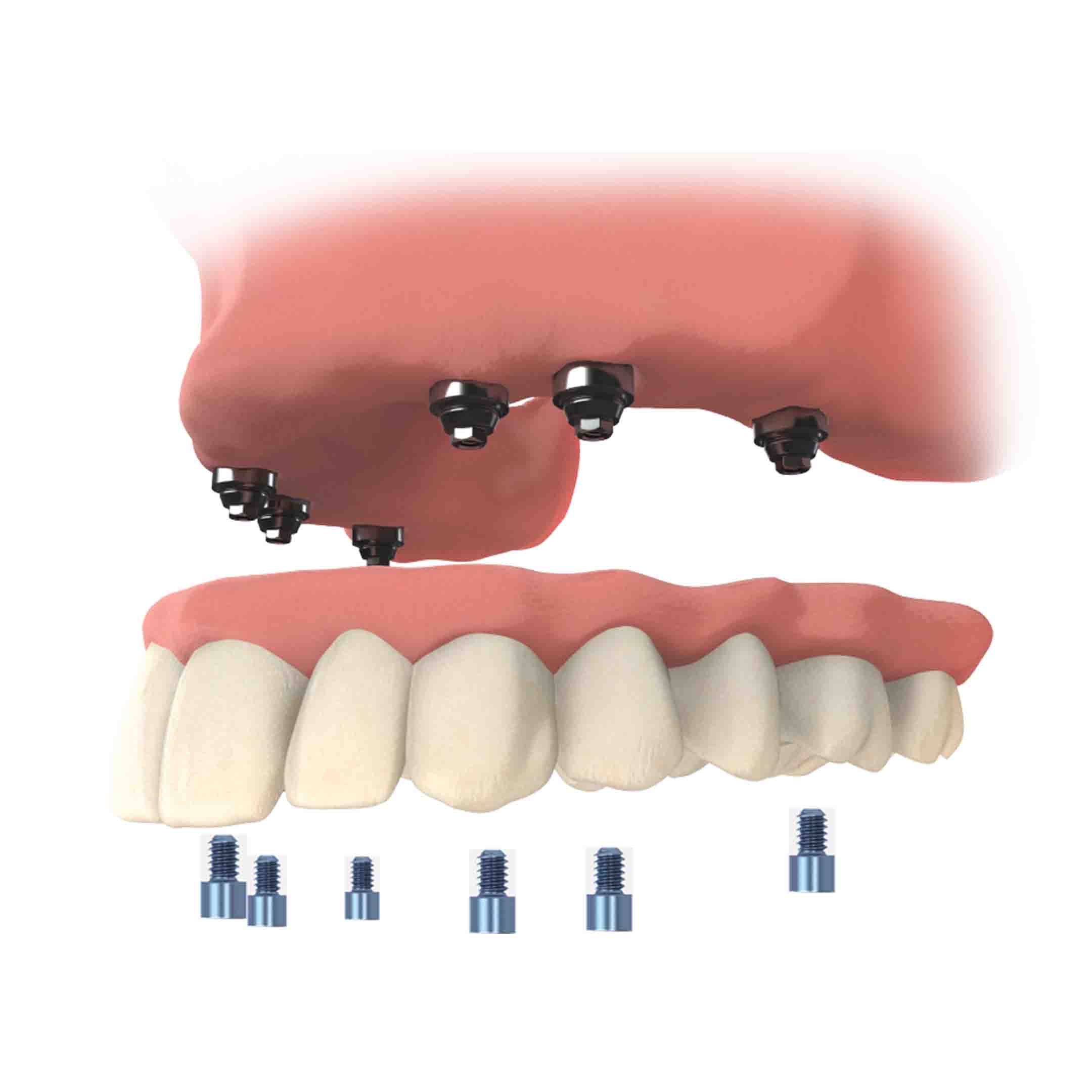 TeethXpress Fix the problems