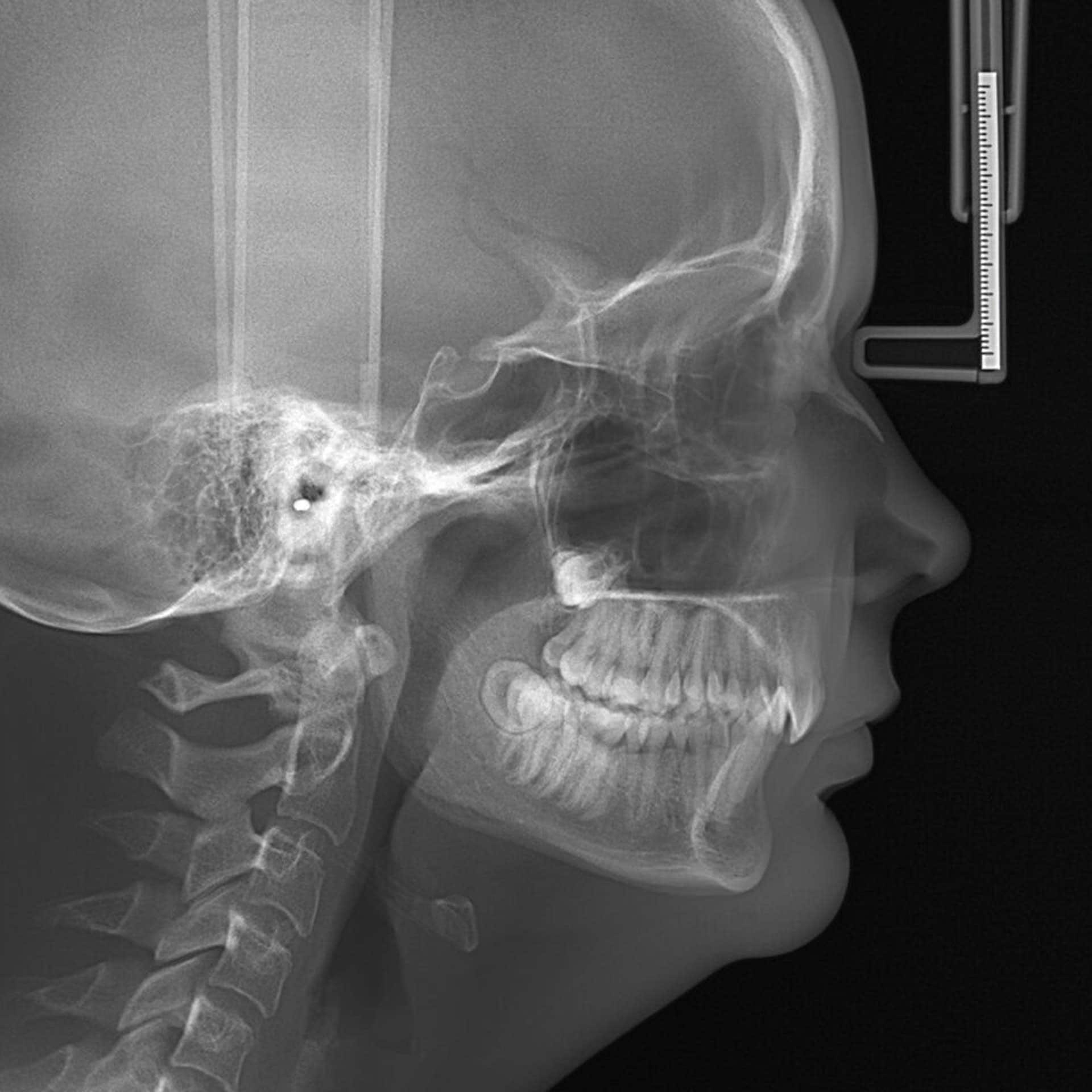 cephalogram x ray
