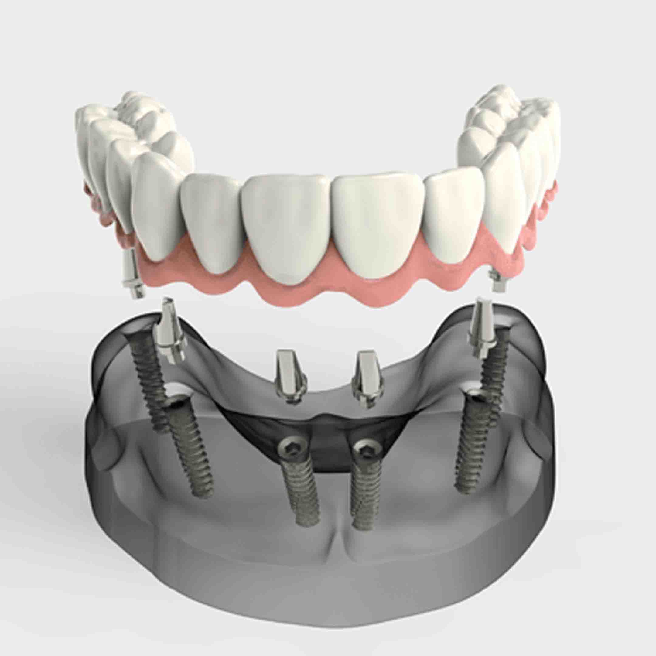 TeethXpress Fresno, CA
