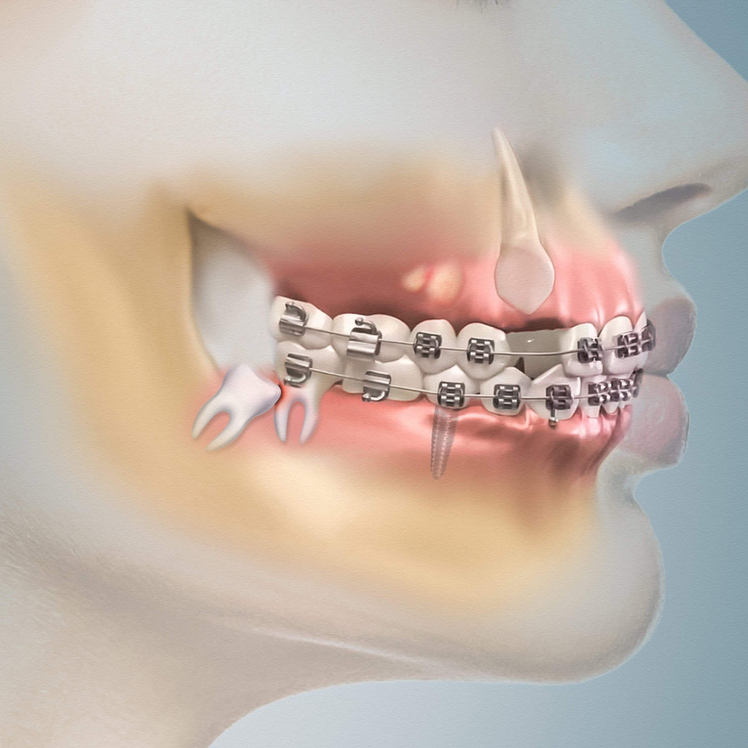 procedures image