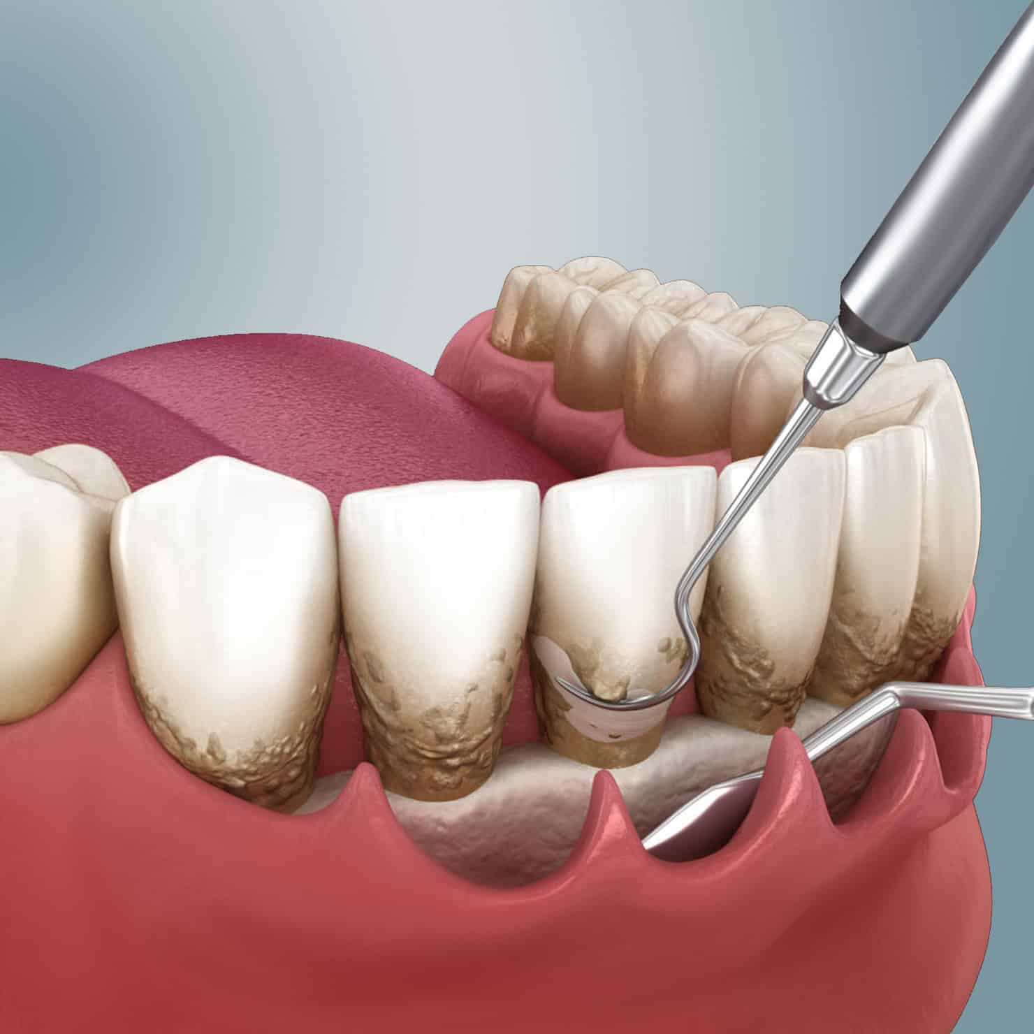 procedures image